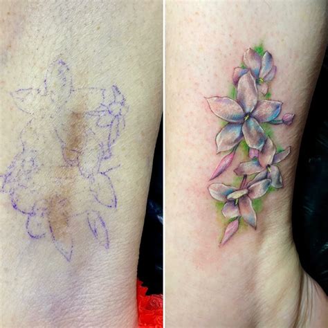 33 Tattoo To Cover Scars Ideas You Will Love 33 Tattoo To Cover Scars Ideas You Will Love