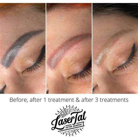 Eyebrow Removal Tattoo