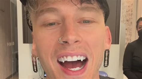 Machine Gun Kelly Unveils His New Diamond Studded Vampire Fangs And Machine Gun Kelly Unveils His New Diamond Studded Vampire Fangs And