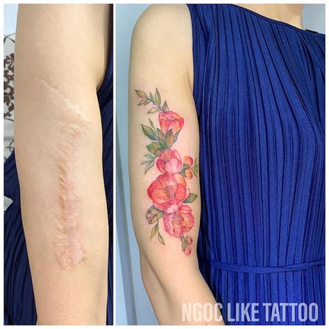 Scar Cover Up Tattoos Help Women Regain Confidence In Their Bodies Scar Cover Up Tattoos Help Women Regain Confidence In Their Bodies