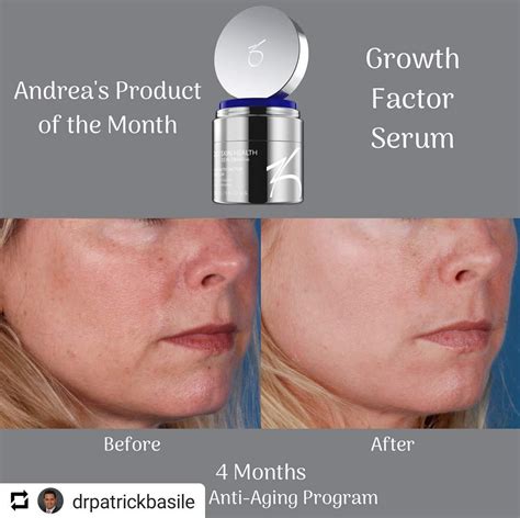 Zo Skin Health Growth Factor Serum